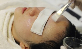 如何改善面部红血丝（面部有红血丝怎么改善）