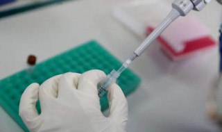 核酸检测前后注意什么（核酸检测前后要注意什么）