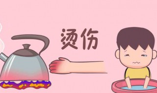 开水烫伤后怎么处理（开水烫伤后怎么办）
