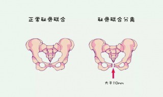 耻骨在哪个位置（耻骨在哪个位置的图片 孕妇）