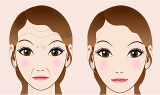 怎样减少抬头纹 怎样减少抬头纹?