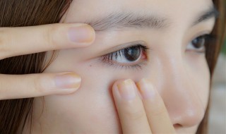 怎样去掉眼角皱纹（怎么去除眼角皱纹?有什么好办法吗?）