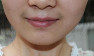 女生如何淡化唇毛 女生如何淡化唇毛