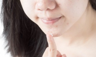 淡化痘印的方法（有效淡化痘印的方法）