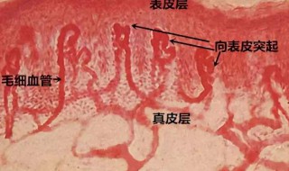 如何消除红血丝 如何消除红血丝眼袋