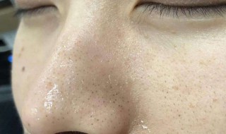 去黑头的小窍门（去黑头的小窍门是什么）