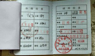 健康证要检查什么项目 餐饮健康证要检查什么项目