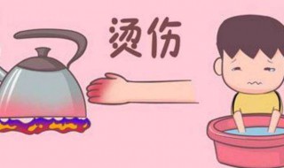 被火烫了怎么解决 不小心被火烫到了怎么办