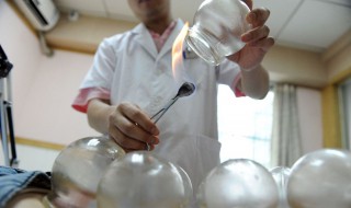拔罐出水泡怎么回事 拔罐出水泡怎么回事 该怎么处理