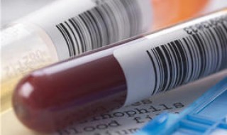 血液制品是指什么 血液制品是指什么意思