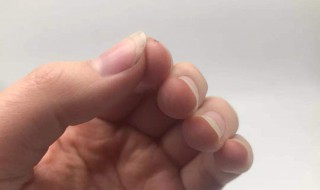 手指甲没有月牙正常吗 儿童手指甲没有月牙正常吗