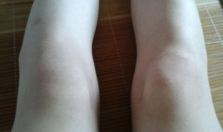 让膝盖变瘦的方法（让膝盖变瘦的方法图片）