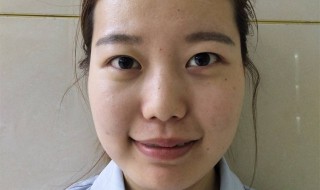 怎样提升面部肌肤（怎样提升面部肌肤的弹性）