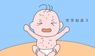 去痱子的最快方法 婴儿去痱子的最快方法