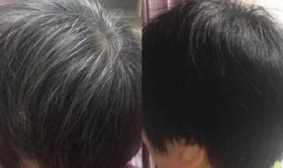 天然染黑发的方法 天然染黑发的方法中药