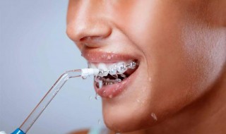 冲牙器正确使用方法 冲牙器正确使用方法视频