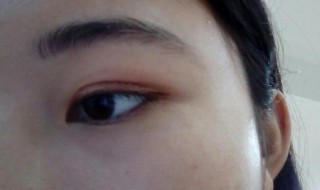 怎样贴双眼皮贴 肿眼泡怎样贴双眼皮贴