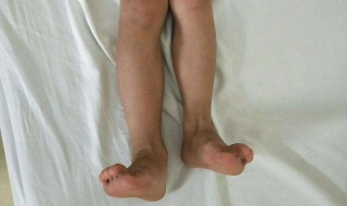 怎样让腿变长 男生怎样让腿变长