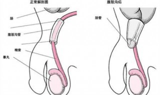 氙气的症状是什么（氙气症状与病因）